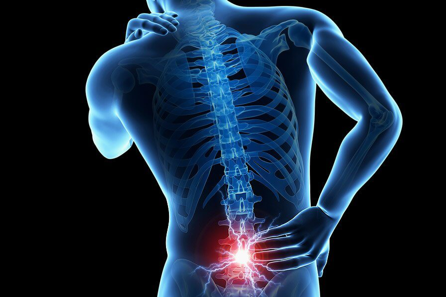 migraines-and-back-pain-are-not-inherited-structural-spinal-care